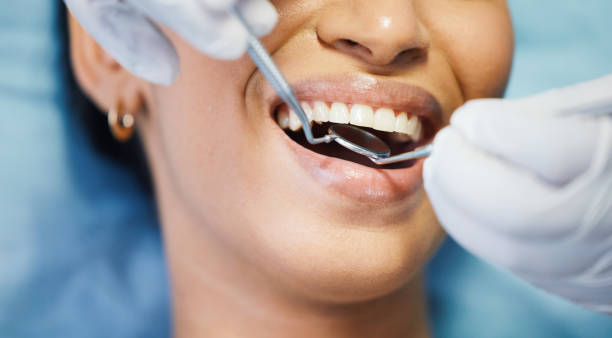 Best Same-Day Emergency Dental Services in Mila Doce, TX