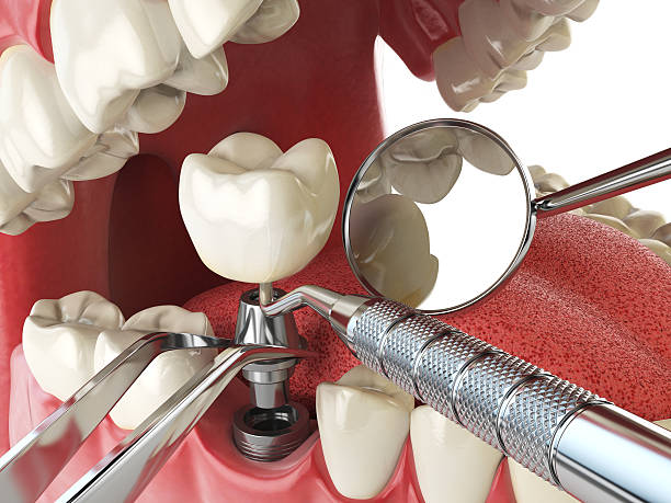 Best Urgent Care for Lost Fillings or Crowns in Mila Doce, TX